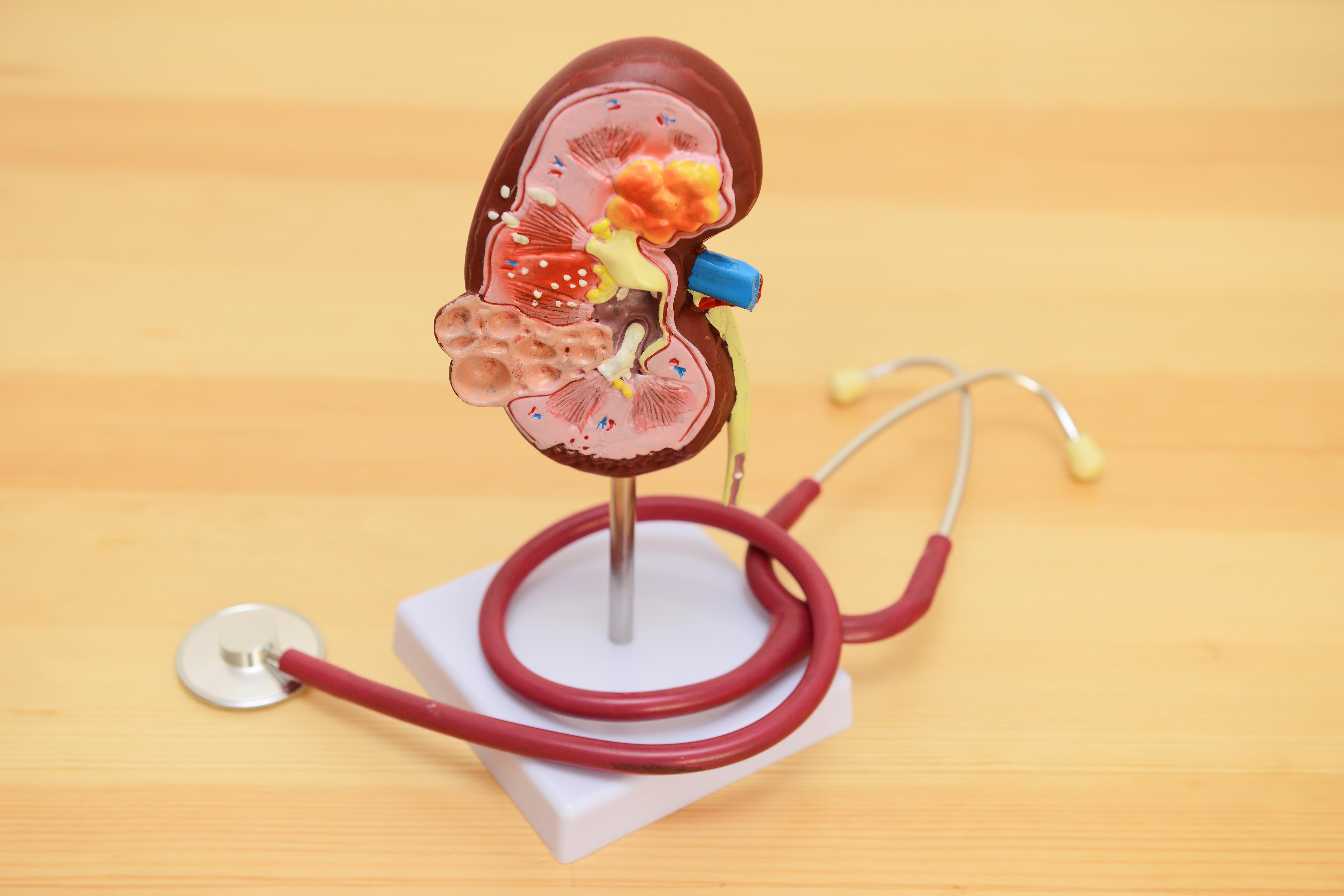 这类病不疼不痒却能一步步榨干你的肾出现这些征兆一定要重视- 新华网客户端